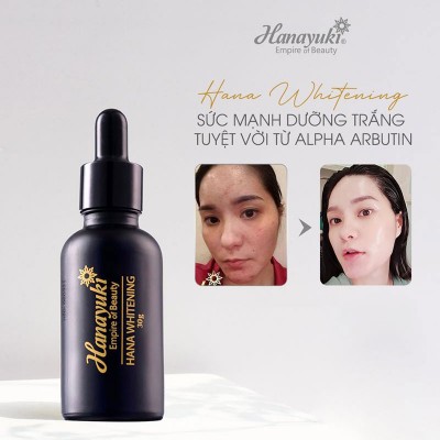 Serum dưỡng trắng da Hana Whitening